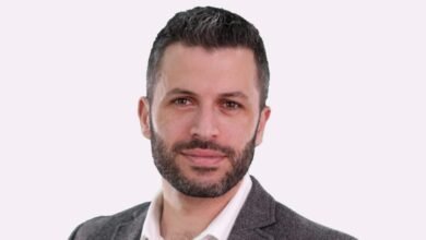 صورة توضيحية - تجميل الذقن باستخدام الفيلر مع الدكتور جورج زيادة