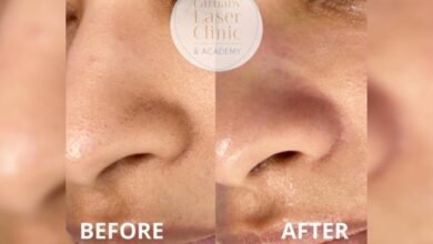 مركز Carnaby Laser Clinic and Academy يُقدم التقنية الأفضل لبشرة نضرة ومتوهجة